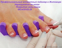 Наращивание ногтей гелем\аппаратный педикюр - <ro>Изображение</ro><ru>Изображение</ru> #7, <ru>Объявление</ru> #640674