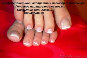 Наращивание ногтей гелем\аппаратный педикюр - <ro>Изображение</ro><ru>Изображение</ru> #5, <ru>Объявление</ru> #640674