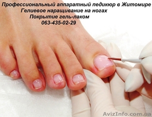 Наращивание ногтей гелем\аппаратный педикюр - <ro>Изображение</ro><ru>Изображение</ru> #6, <ru>Объявление</ru> #640674