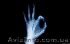 Куплю ДОРОГО отработанный фиксаж, кинопленку, рентгенпленку!