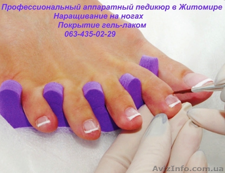 Наращивание ногтей гелем\аппаратный педикюр - <ro>Изображение</ro><ru>Изображение</ru> #7, <ru>Объявление</ru> #640674